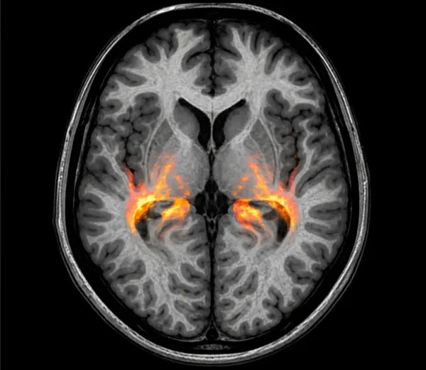 Brain imaging — gamma activity research