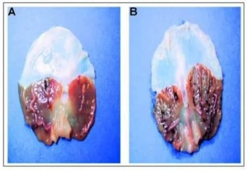 pineal-gland